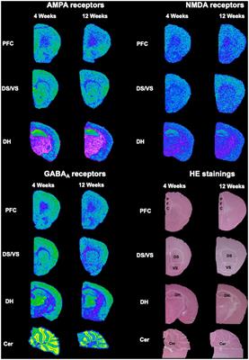 Neuroanatomical changes of ionotropic glutamatergic and GABAergic receptor densities in male mice modeling idiopathic and syndromic autism spectrum disorder